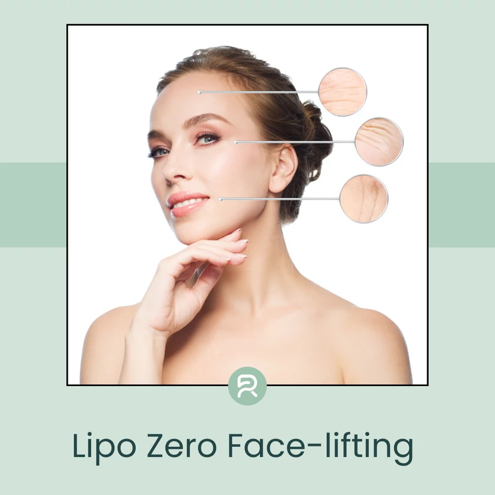 LipoZero Face-lifting